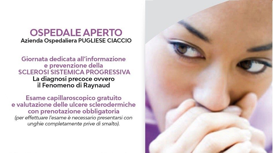Sclerosi Sistemica, se ne parla ancora poco. Incontro all’ospedale Pugliese-Ciaccio