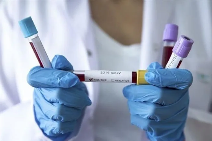 Coronavirus in Calabria: totale positivi