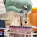 Covid, Regione aderisce a progetto europeo per raccolta plasma. Spirlì: «Donare per salvare vite»